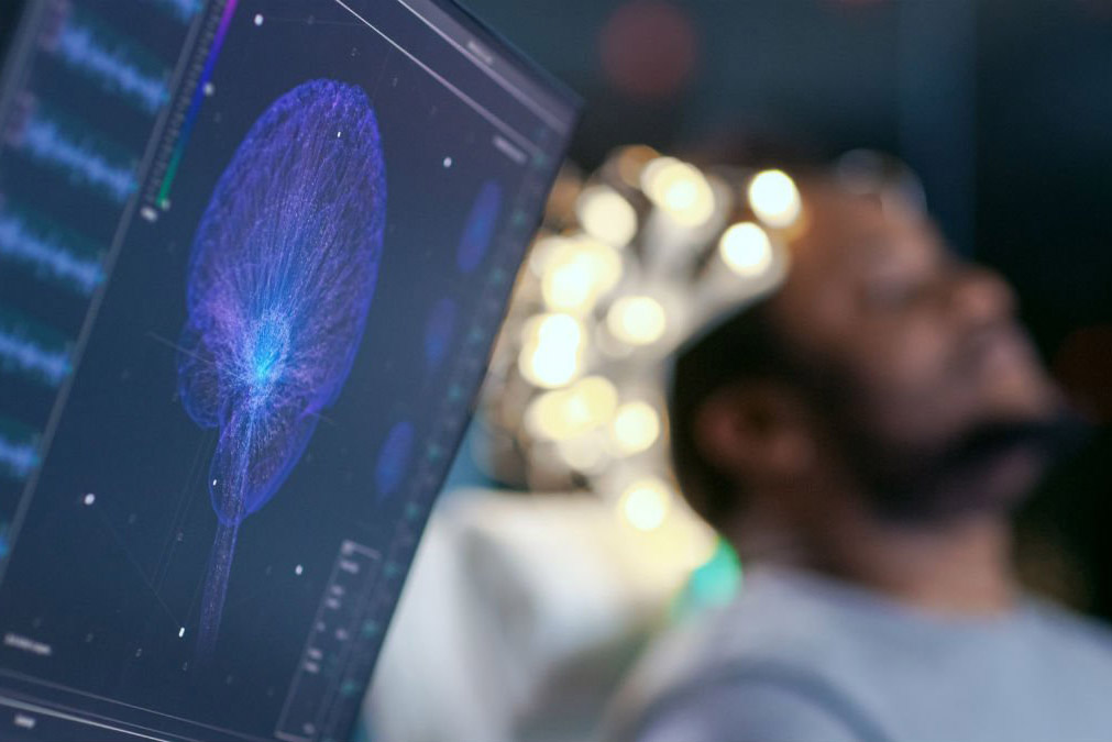 Monitoring brain activity